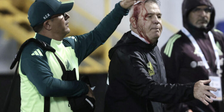 TOPSHOT - Mexico's coach, Javier Aguirre, is helped by an assistant after being injured in the head when he was hit by an object thrown from the bleachers at the end of the National League of CONCACAF quarterfinal first leg match between Honduras and Mexico on November 15, 2024. (Photo by JHONY MAGALLANES/AFP via Getty Images)