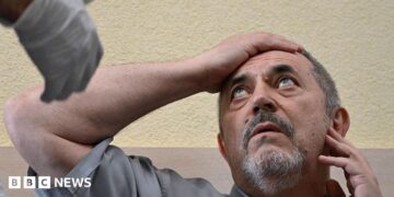 A man in a grey shirt holds his right arm to his forehead as he looks at a man out of the picture who is wearing a medical glove