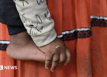 A close-up of a small child’s bare foot and hand is shown against a backdrop of their mother's skirt - a traditional indigenous outfit. It appears the child is being held by their mother. The child is wearing a light-coloured sleeve printed with a simple cartoon dog, and the hand hangs loosely beside the foot.