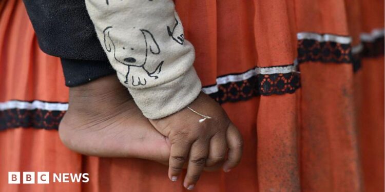 A close-up of a small child’s bare foot and hand is shown against a backdrop of their mother's skirt - a traditional indigenous outfit. It appears the child is being held by their mother. The child is wearing a light-coloured sleeve printed with a simple cartoon dog, and the hand hangs loosely beside the foot.