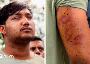 Sahil Lochab's face and right arm which show the pellet gun wounds on his body