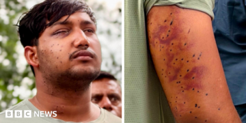 Sahil Lochab's face and right arm which show the pellet gun wounds on his body