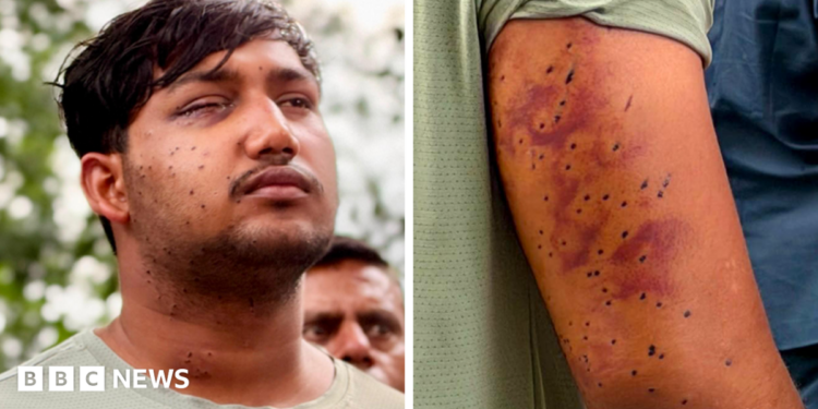 Sahil Lochab's face and right arm which show the pellet gun wounds on his body