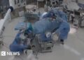 CCTV image of an operating room with doctor falling over and grabbing the operating table