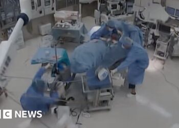 CCTV image of an operating room with doctor falling over and grabbing the operating table