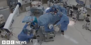 CCTV image of an operating room with doctor falling over and grabbing the operating table